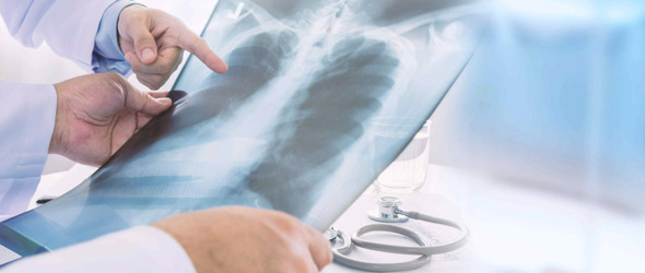 Bpco: ritardi nella diagnosi e bassa aderenza alla terapia