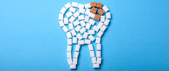 “Sugar tax” e salute dei denti, è confermato il legame
