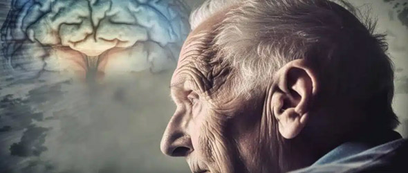Demenza, nei prossimi 20 anni i casi nel mondo raggiungeranno 140 milioni