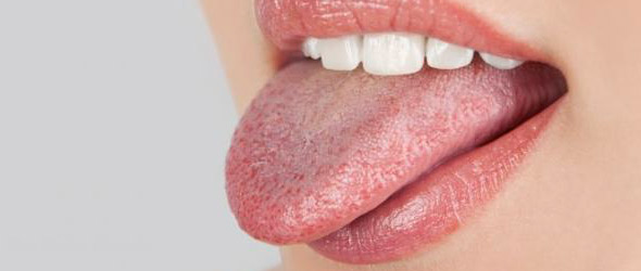  Ulcere e discromie linguali segnalano che si tratta di Covid