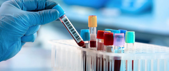 I numeri del cancro al pancreas in Europa