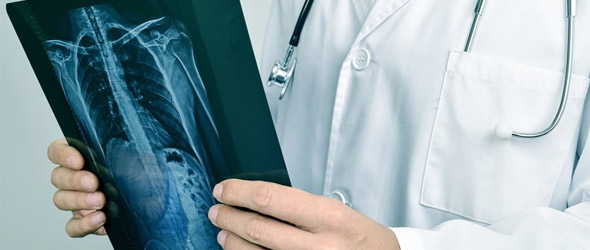 Virus Respiratorio Sinciziale negli adulti: un rischio emergente che richiede prevenzione