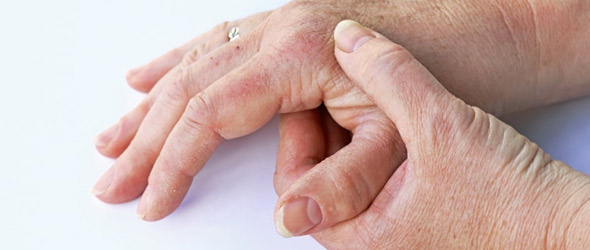 Artrite psoriasica: la diagnosi precoce previene danni permanenti