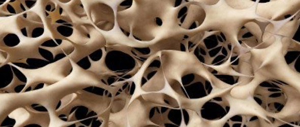 Malattie ossee rare: urge intervento su prevenzione e percorsi di cura