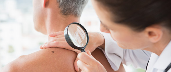 Melanoma, la diagnosi precoce passa dal Medico di medicina generale