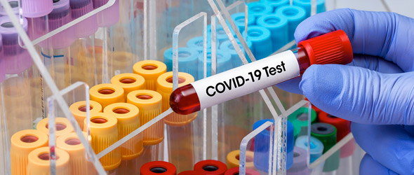 Nell’indagine sierologica ‘anti Covid’ vanno coinvolti i Mmg