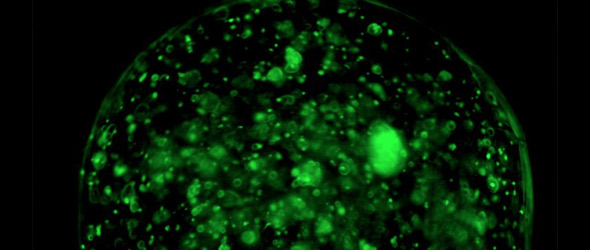 Nuove tecniche di fototerapia per il trattamento del cancro