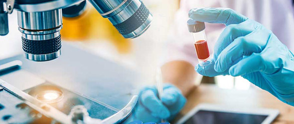 Diagnosi tempestiva di lesioni precancerose con la biopsia liquida