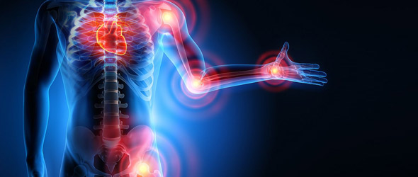 Artrosi e rischio cardiovascolare: una relazione biunivoca