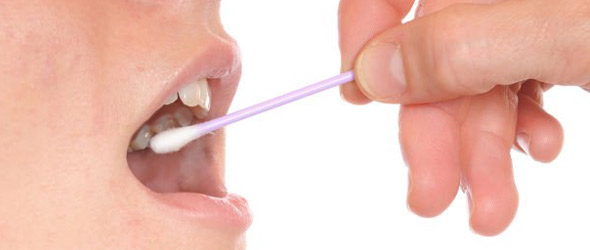 Tumori orofaringei da Hpv: il primo test per la diagnosi precoce