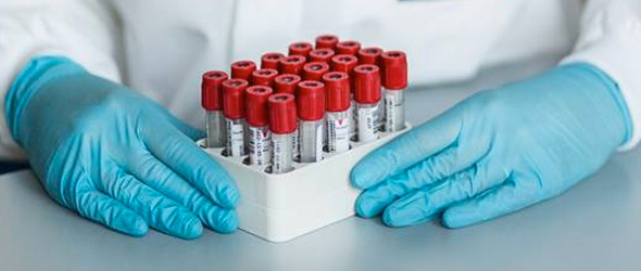 FDA autorizza test per il COVID-19 di Diasorin
