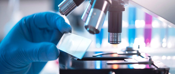 Identificato un nuovo biomarcatore di gravità del Covid-19