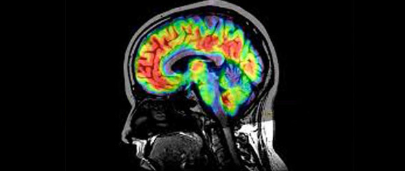 La diagnosi precoce dell’Alzheimer con una nuova tecnica 