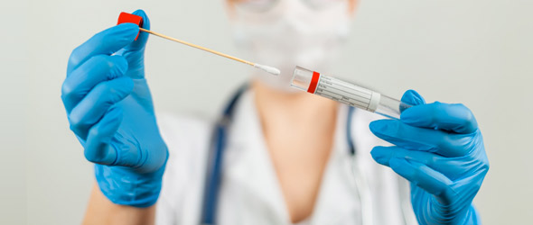SIMIT: Caos tamponi, le indicazioni degli infettivologi
