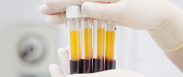 Isolati anticorpi monoclonali che neutralizzano anche le varianti