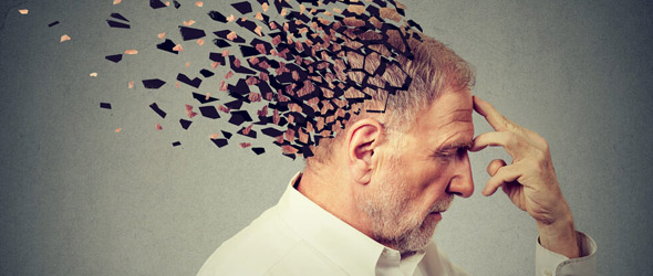Dall’Fda ok a donanemab per la malattia di Alzheimer sintomatica precoce