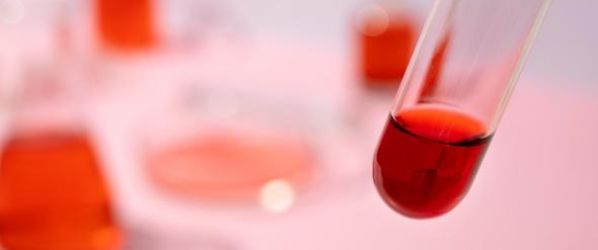 Aggiornate le linee guida per le dislipidemie