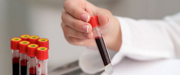 Così la profilazione lipoproteica può salvare vite umane