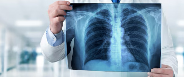 Fattori predittivi di ospedalizzazione e mortalità nella Bpco